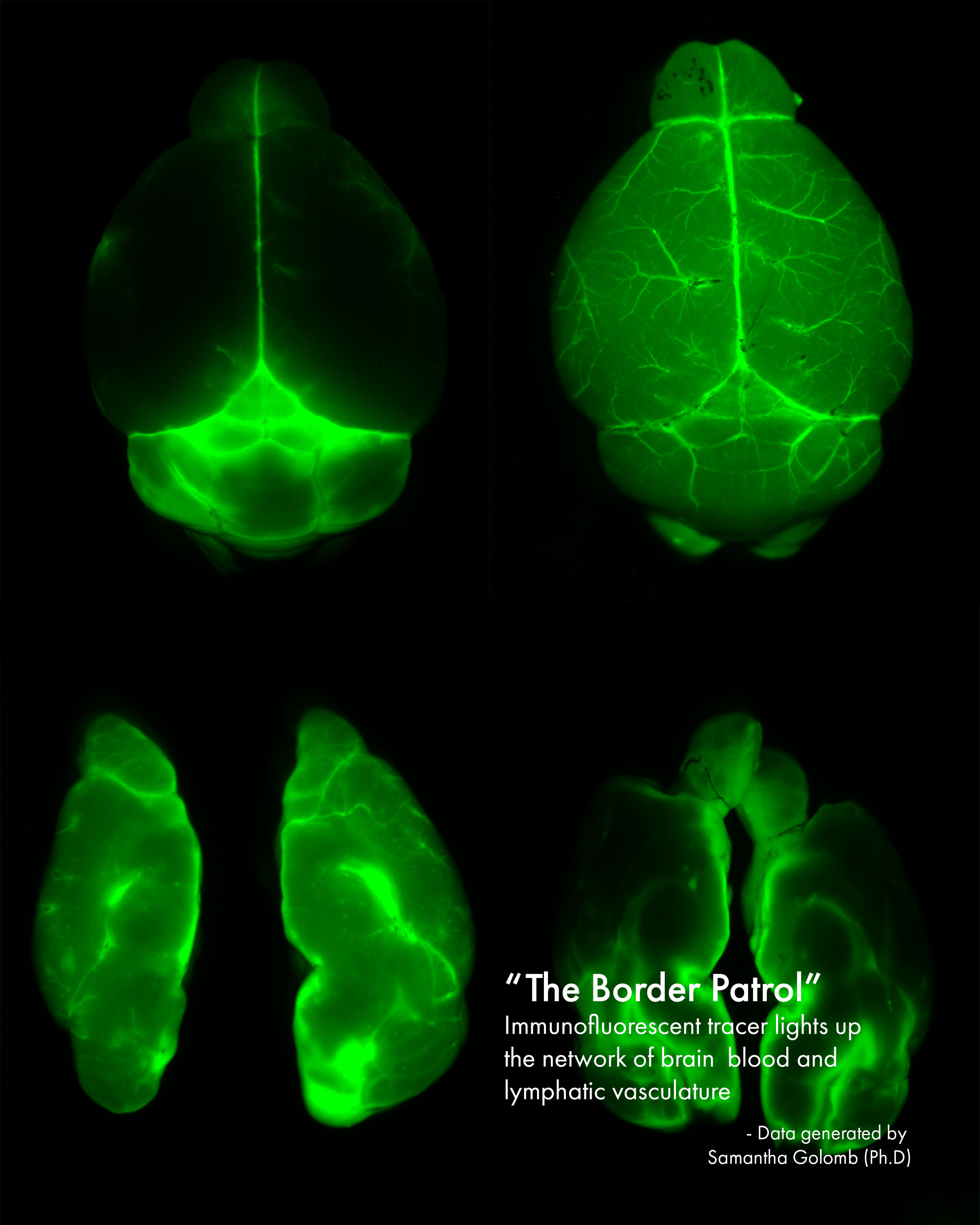 Mapping the Brain Lymphatics