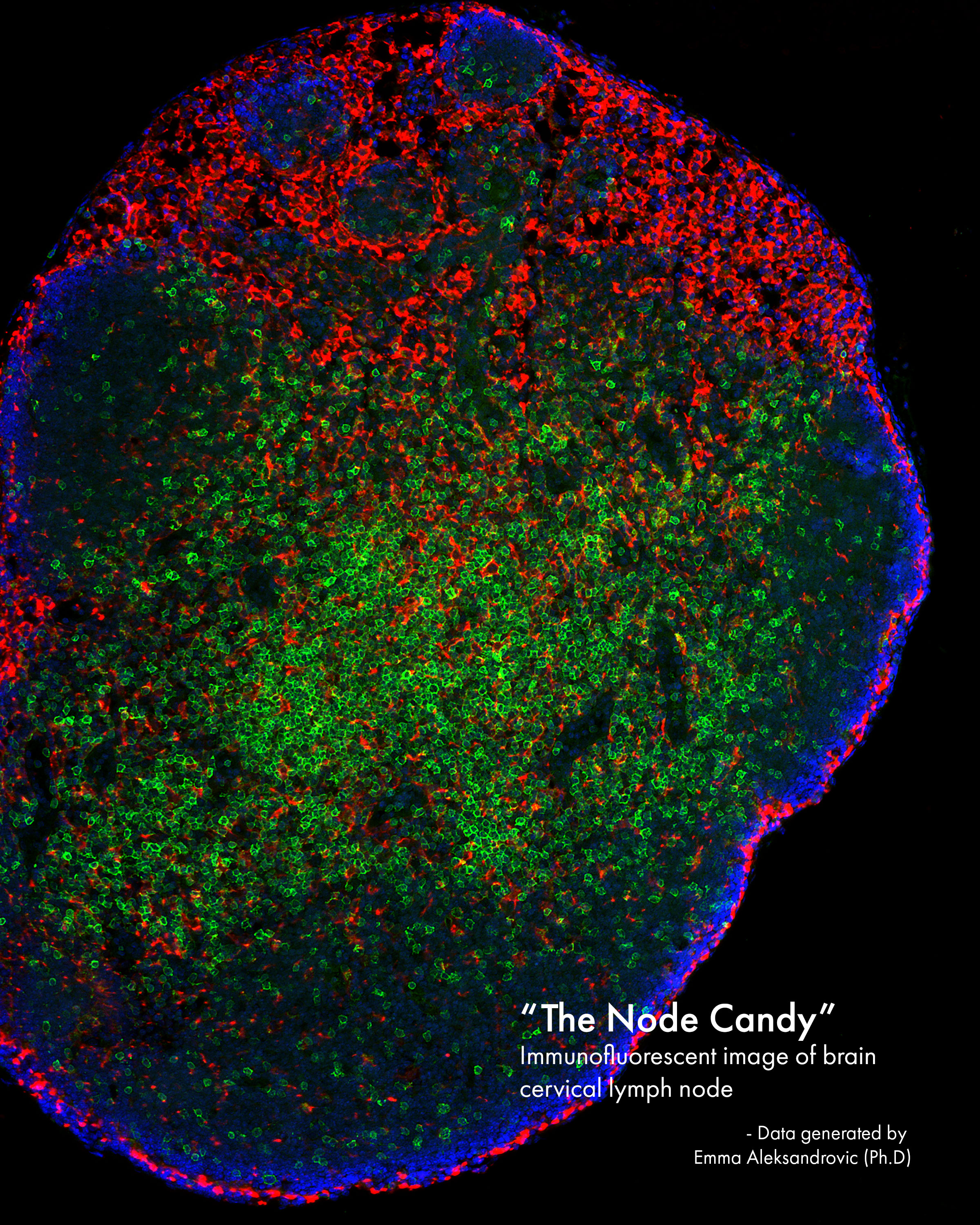 Deep Cervical Lymph Node (dCLN) Candy